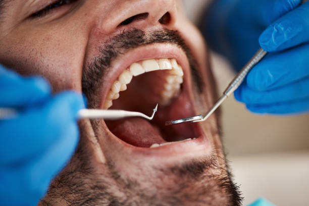 Best Emergency Dental Care for Abscessed Tooth in Thermopolis, WY